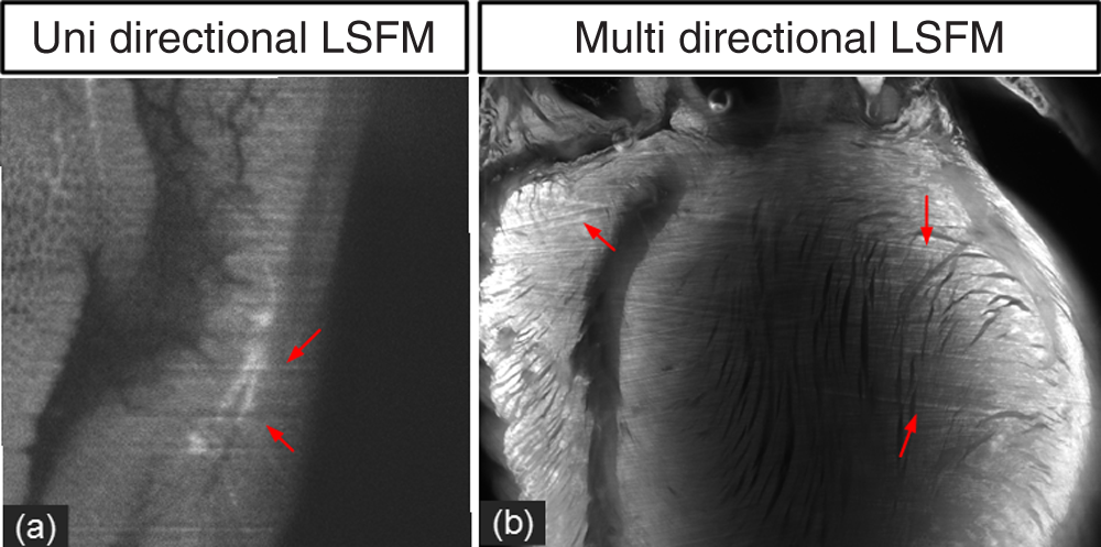 Stripe artifact elimination based on nonsubsampled contourlet transform for light sheet fluorescence microscopy