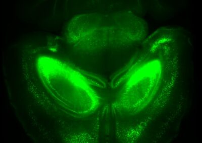 High resolution 3D imaging of primary and secondary tumor spheroids using multicolor multi-angle Light Sheet Fluorescence Microscopy (LSFM)