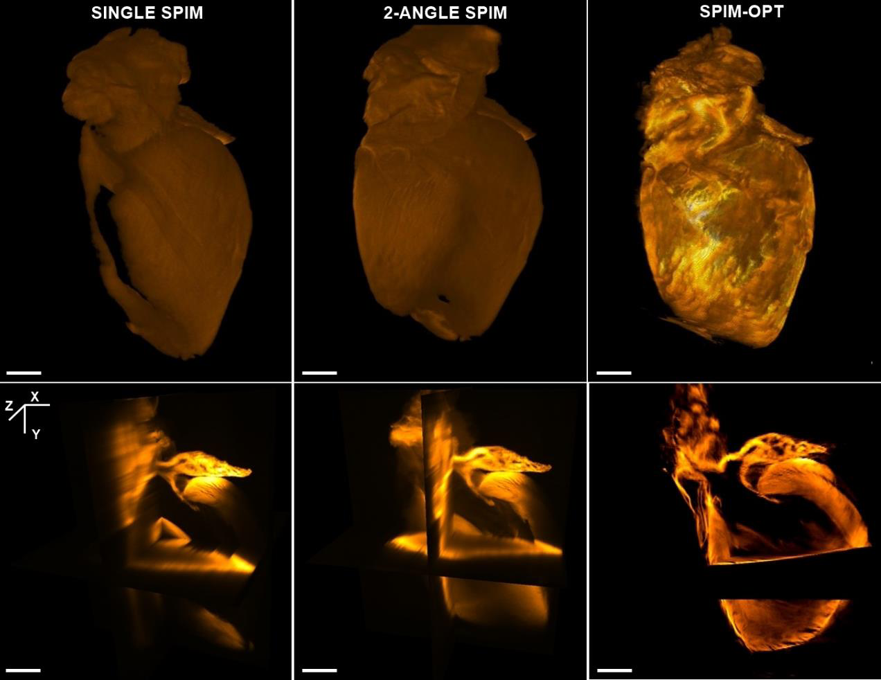 Increased resolution through the sample with single-, multiple- and 500 angle SPIM-OPT