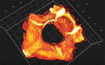 New Publication with a QLS-SCOPE  Lightsheet : Molecular Imaging of Collagen Destruction of the Spine