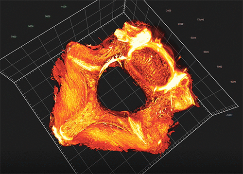 New Publication with a QLS-SCOPE  Lightsheet : Molecular Imaging of Collagen Destruction of the Spine